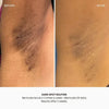 Dark Spot Oil - Bermuda