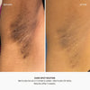 Dark Spot Oil - Bermuda