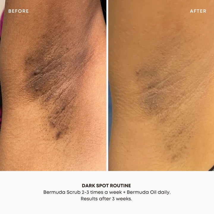 Dark Spot Oil - Bermuda