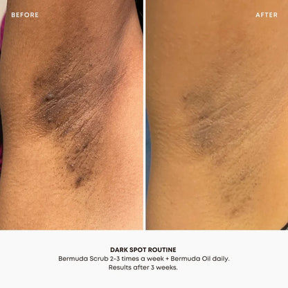 Dark Spot Oil - Bermuda