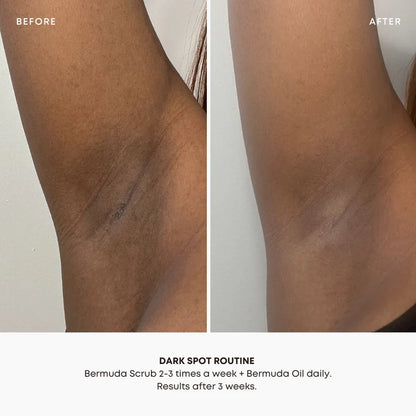 Dark Spot Oil - Bermuda